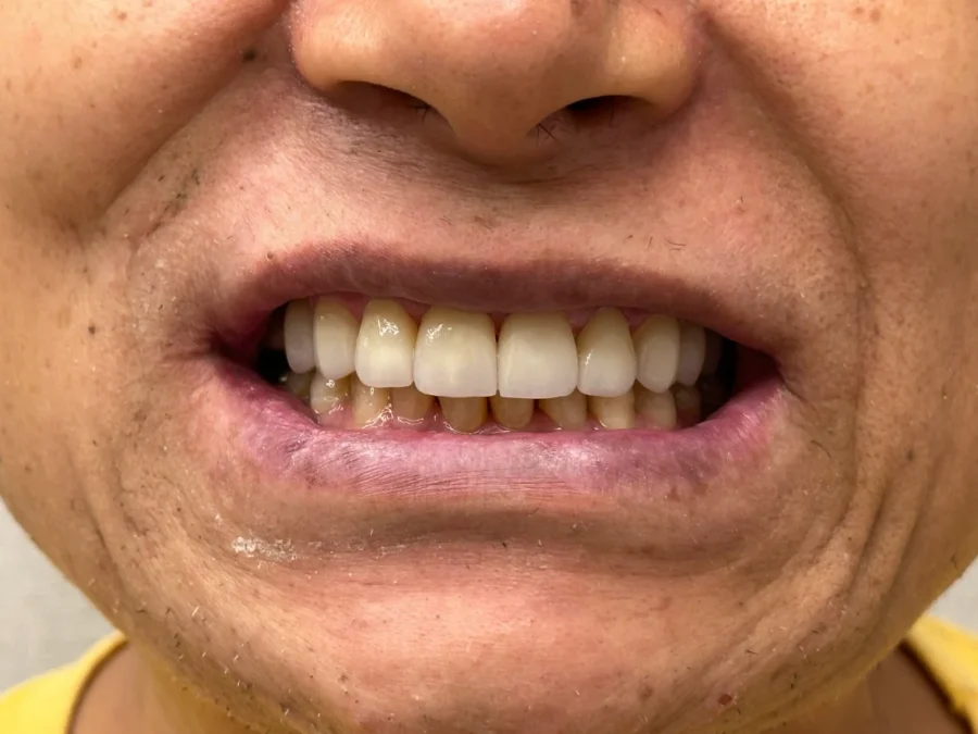 Foto depois paciente 4